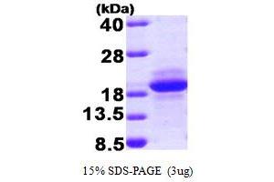 SDS-PAGE (SDS) image for Multiple Coagulation Factor Deficiency 2 (MCFD2) (AA 27-146) protein (T7 tag) (ABIN666930) (MCFD2 Protein (AA 27-146) (T7 tag))