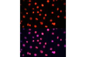 Immunofluorescence analysis of C6 cells using SOX2 Polyclonal Antibody (ABIN6130648, ABIN6148295, ABIN6148297 and ABIN6215241) at dilution of 1:100 (40x lens). (SOX2 antibody  (AA 1-140))