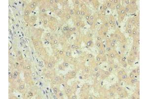 Immunohistochemistry of paraffin-embedded human liver using  in 30 μg/mL dilute concentrations. (CRP antibody)