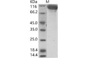 Western Blotting (WB) image for Glyco protein (Fc Tag) (ABIN7195953) (Glyco protein (Fc Tag))