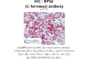 Image no. 1 for anti-Ribosomal Protein S6 (RPS6) antibody (ABIN1738946) (RPS6 antibody)