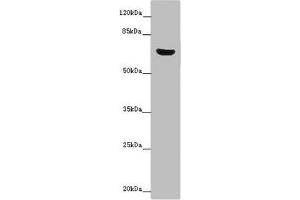 Western blot All lanes: CERKL antibody at 14 μg/mL + Mouse lung tissue Secondary Goat polyclonal to rabbit IgG at 1/10000 dilution Predicted band size: 63, 60, 53, 48, 43, 25, 20, 58 kDa Observed band size: 63 kDa (CERKL antibody  (AA 1-558))