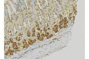 ABIN6273356 at 1/100 staining Human gastric tissue by IHC-P. (MCF2L antibody  (Internal Region))