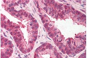 Human Prostate (formalin-fixed, paraffin-embedded) stained with TMED10 antibody ABIN214530 at 3 ng/ul followed by biotinylated goat anti-rabbit IgG secondary antibody ABIN481713, alkaline phosphatase-streptavidin and chromogen. (TMED10 antibody  (C-Term))