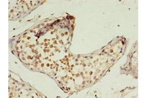 Immunohistochemistry of paraffin-embedded human testis tissue using ABIN7163399 at dilution of 1:100