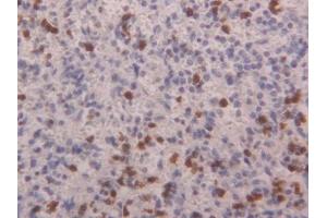 Detection of S100A4 in Human Spleen Tissue using Polyclonal Antibody to S100 Calcium Binding Protein A4 (S100A4) (s100a4 antibody  (AA 2-101))