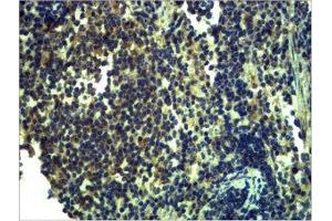 Immunohistochemical analysis of paraffin-embedded Mouse Spleen Tissue using TLR13 Polyclonal Antibody. (TLR13 antibody)