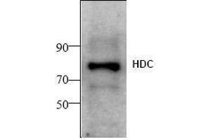 Image no. 1 for anti-Histidine Decarboxylase (HDC) antibody (ABIN155152) (HDC antibody)