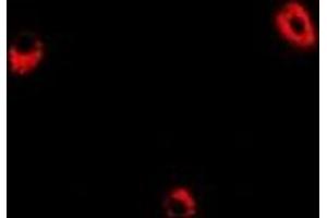 Immunofluorescent analysis of ADSS staining in Hela cells. (ADSS antibody)