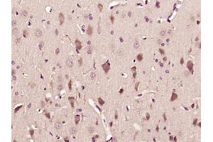 Paraformaldehyde-fixed, paraffin embedded Rat brain Antigen retrieval by boiling in sodium citrate buffer (pH6. (GABBR2 antibody  (AA 501-650))