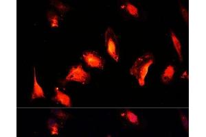 Immunofluorescence analysis of U-2 OS cells using MYST1 Polyclonal Antibody at dilution of 1:100 (40x lens). (MYST1 antibody)