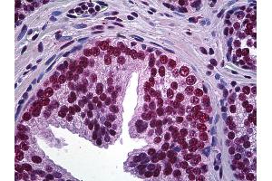 Anti-LHX4 antibody IHC of human prostate. (LHX4 antibody  (AA 291-390))