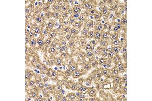 Immunohistochemistry of paraffin-embedded rat liver using UBE2J2 antibody.