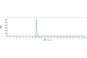 anti-ROR2 (Ozuriftamab Biosimilar) antibody