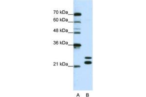 Western Blotting (WB) image for anti-Cold Shock Domain Containing C2, RNA Binding (CSDC2) antibody (ABIN2462255) (CSDC2 antibody)
