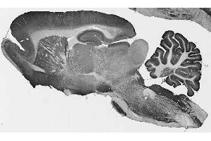 Adult rat brain immunohistochemistry. (CLCN3 antibody  (Cytosolic, N-Term))