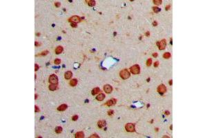 Immunohistochemical analysis of Fibulin 4 staining in human brain formalin fixed paraffin embedded tissue section. (FBLN4 antibody  (Center))