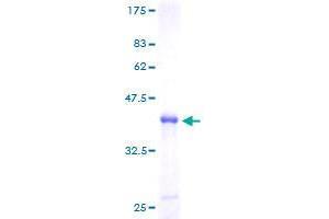 ZNF593 Protein (AA 1-116) (GST tag)
