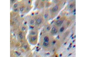 Used in DAB staining on fromalin fixed paraffin-embedded Liver tissue (CCL16 antibody  (AA 20-120))