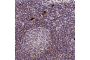 Immunohistochemical staining (Formalin-fixed paraffin-embedded sections) of human lymph node with CSF3R polyclonal antibody  shows strong cytoplasmic positivity in a subset of leukocytes and weak cytoplasmic staining in non-germinal center cells. (CSF3R antibody  (AA 420-543))