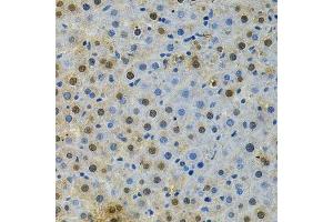Immunohistochemistry of paraffin-embedded rat liver using BUB1 Antibody. (BUB1 antibody  (AA 1-300))