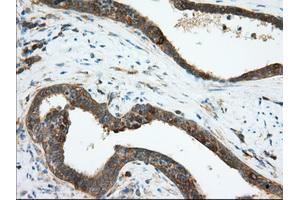 Image no. 6 for anti-Transforming, Acidic Coiled-Coil Containing Protein 3 (TACC3) antibody (ABIN1498098) (TACC3 antibody)