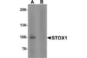Western blot analysis of STOX1 in human liver tissue lysate with STOX1 antibody at 1 ug/ml in (A) the absence and (B) the presence of blocking peptide.