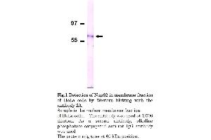 Western Blotting (WB) image for anti-Nucleoporin 62kDa (NUP62) (AA 1-179), (Phenylalanine-Glycine Repeat) antibody (ABIN2452063) (NUP62 antibody  (Phenylalanine-Glycine Repeat))