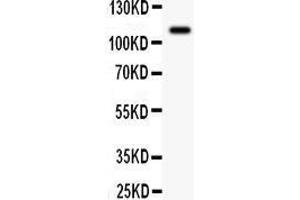 Anti- C-Kit Picoband antibody, Western blotting All lanes: Anti C-Kit  at 0. (KIT antibody  (AA 26-285))