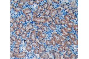 Used in DAB staining on fromalin fixed paraffin- embedded kidney tissue (BNP antibody  (AA 27-121))