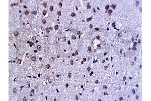 Formalin-fixed and paraffin embedded rat brain tissue labeled Anti-C-Jun Polyclonal Antibody (ABIN671691), Unconjugated at 1:200, followed by conjugation to the secondary antibody and DAB staining