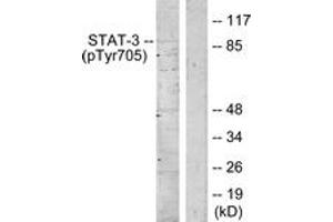 Image no. 2 for anti-Signal Transducer and Activator of Transcription 3 (Acute-Phase Response Factor) (STAT3) (pTyr705) antibody (ABIN2888531) (STAT3 antibody  (pTyr705))