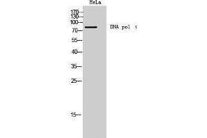 Western Blotting (WB) image for anti-DNA Polymerase I (C-Term) antibody (ABIN3174788) (DNA Polymerase I (C-Term) antibody)