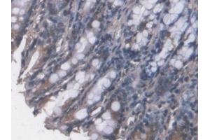 DAB staining on IHC-P; Samples: Mouse Colon Tissue (FPGT antibody  (AA 314-513))