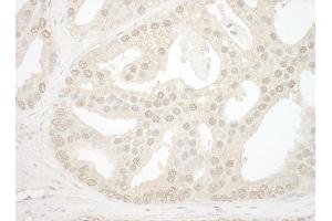 Immunohistochemistry (IHC) image for anti-Nucleolar Protein 12 (NOL12) (AA 75-125) antibody (ABIN7454466)