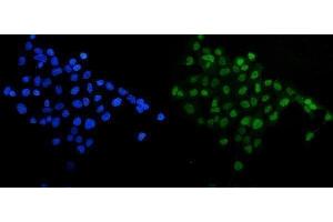 anti-Sirtuin 1 (SIRT1) (AA 112-311) antibody
