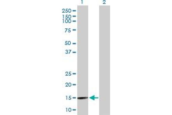 BRWD1 anticorps  (AA 1-120)