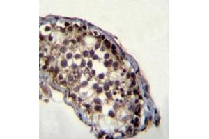 Immunohistochemistry analysis in formalin fixed and paraffin embedded human testis tissue reac ted with JHDM2a Antibody (C-term) followed which was peroxidase conjugated to the secondary antibody and followed by DAB staining.