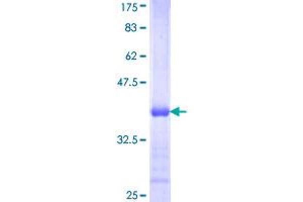 Acsl3 Protein (AA 203-288) (GST tag)