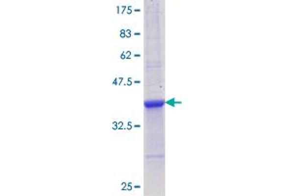 IL12A Protein (AA 144-253) (GST tag)