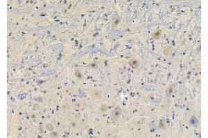 Phospho-Synapsin I (Ser62/Ser67) Antibody at 1/100 staining Rat brain tissue by IHC-P.