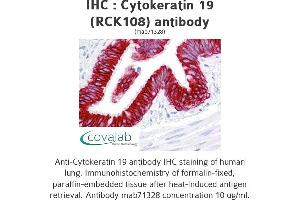 Image no. 1 for anti-Keratin 19 (KRT19) antibody (ABIN1724421) (Cytokeratin 19 antibody)