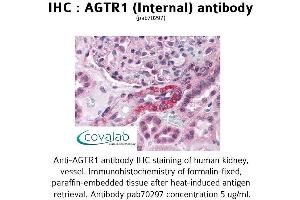 Image no. 2 for anti-Angiotensin II Receptor, Type 1 (AGTR1) (Internal Region) antibody (ABIN1731610) (Angiotensin II Type-1 Receptor antibody  (Internal Region))