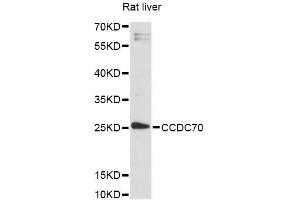 Western blot analysis of extracts of rat liver, using CCDC70 antibody (ABIN6292810) at 1:3000 dilution. (CCDC70 antibody)