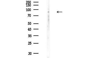anti-Cadherin 18, Type 2 (CDH18) (N-Term) antibody
