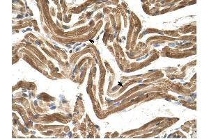 FICD antibody was used for immunohistochemistry at a concentration of 4-8 ug/ml to stain Skeletal muscle cells (arrows) in Human Muscle.