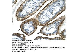 Human Intestine (GABRP antibody  (N-Term))
