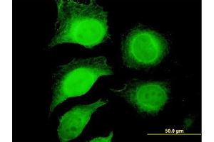 Immunofluorescence of purified MaxPab antibody to GAPDH on HeLa cell. (GAPDH antibody  (AA 1-335))
