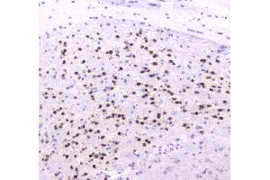 IHC analysis of ESRRG using anti-ESRRG antibody . (ESRRG antibody  (AA 302-458))