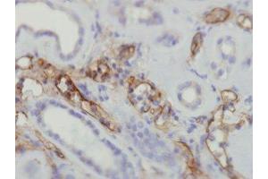 Immunohistochemistry (IHC) image for anti-Complement Component C4d (C4d) antibody (ABIN870587) (Complement C4d antibody)